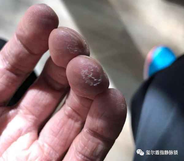 璽爾盾指靜脈鎖告訴您給老年人購(gòu)買智能鎖需要注意什么